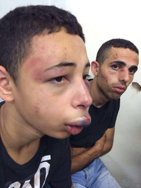 Action: Demand the release of Tarek Abu Khdeir